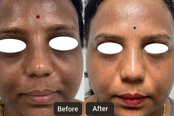 Skin Care Specialist in Chandigarh | Skinology Plus by Dr. Sheenam